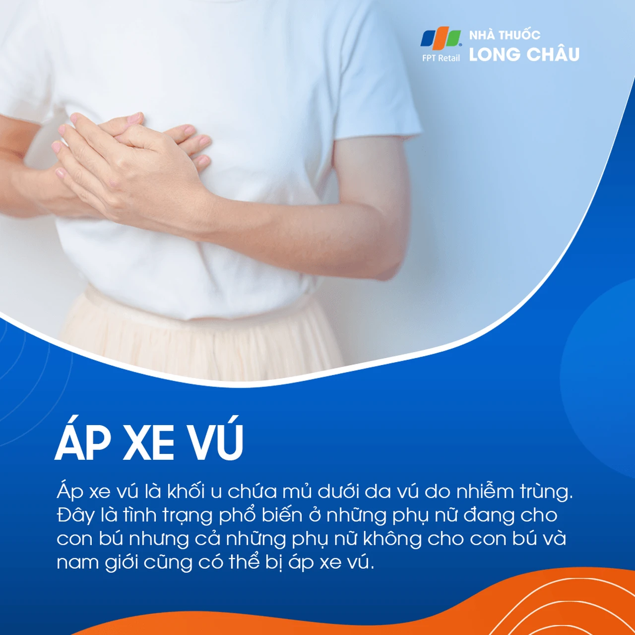 Áp xe vú là khối u mủ dưới da vú do nhiễm trùng, phổ biến ở phụ nữ cho con bú