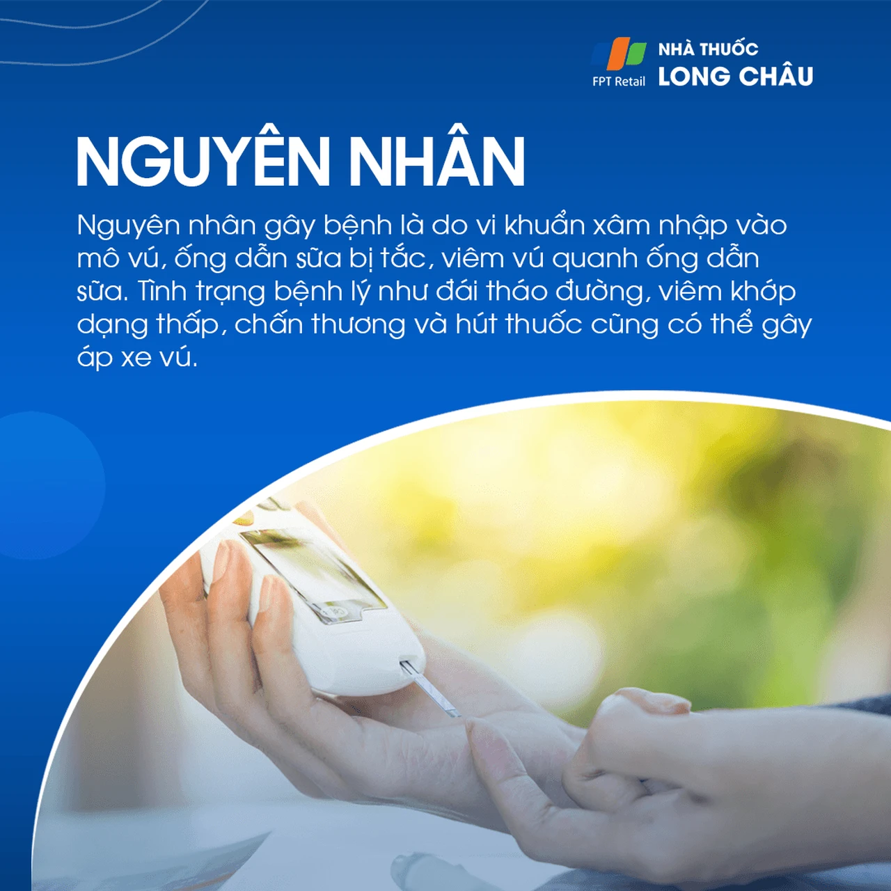 Nguyên nhân áp xe vú do vi khuẩn xâm nhập, tắc ống dẫn sữa, viêm vú hoặc bệnh nền