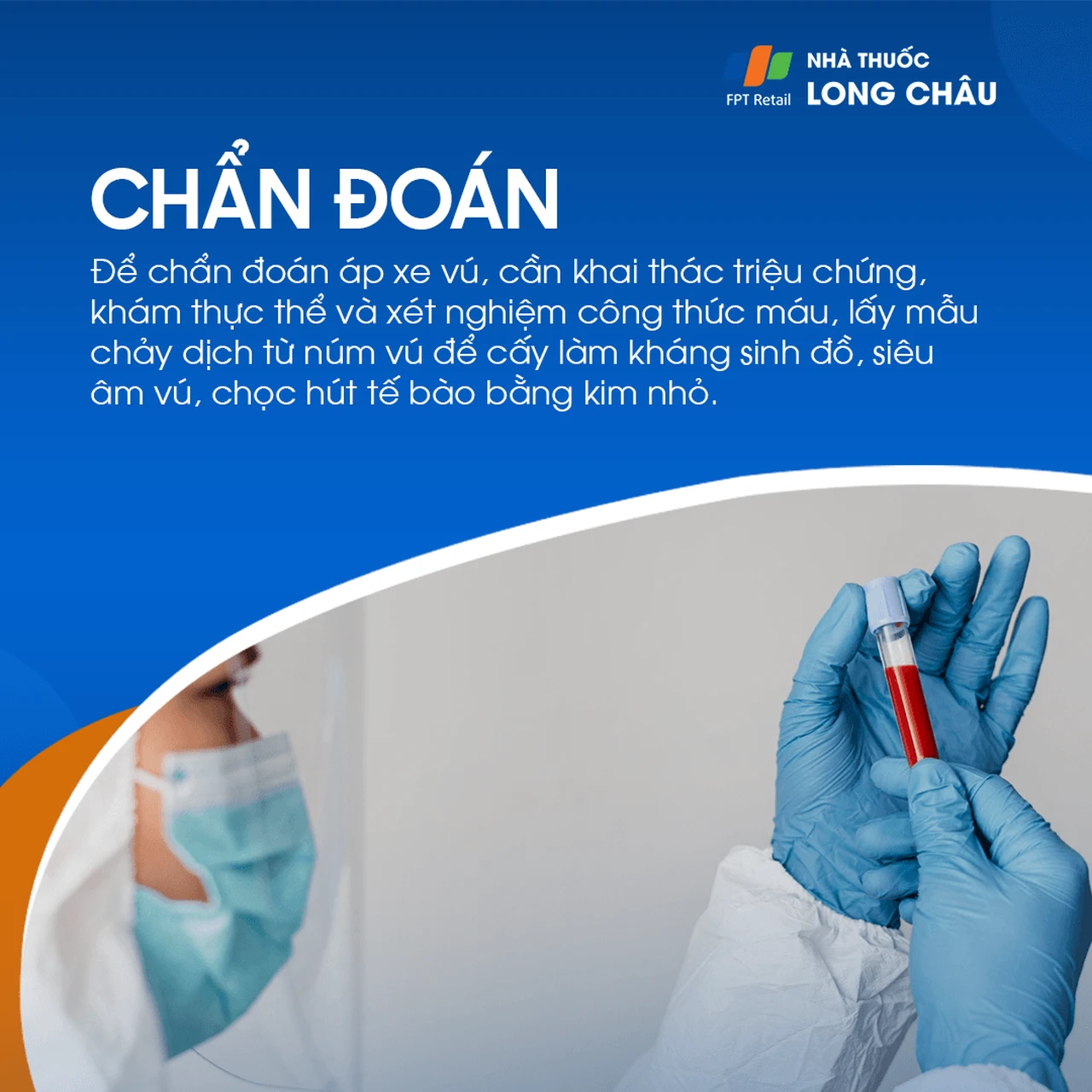 Chẩn đoán áp xe vú bằng khám lâm sàng, siêu âm, xét nghiệm máu và cấy dịch từ núm vú