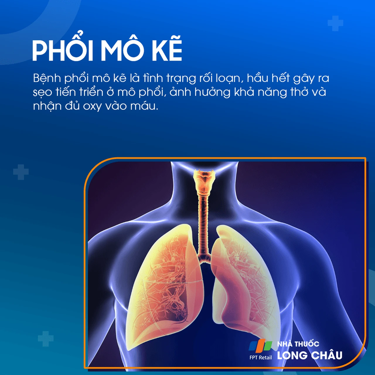 Phổi mô kẽ 1
