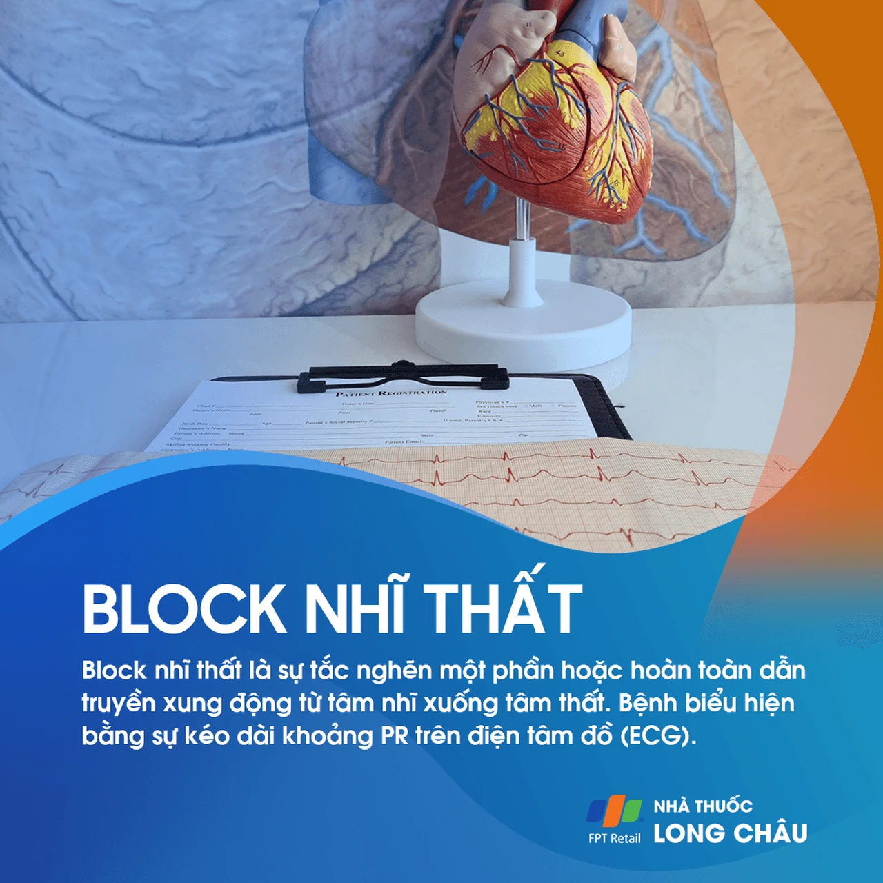 Block nhĩ thất 1