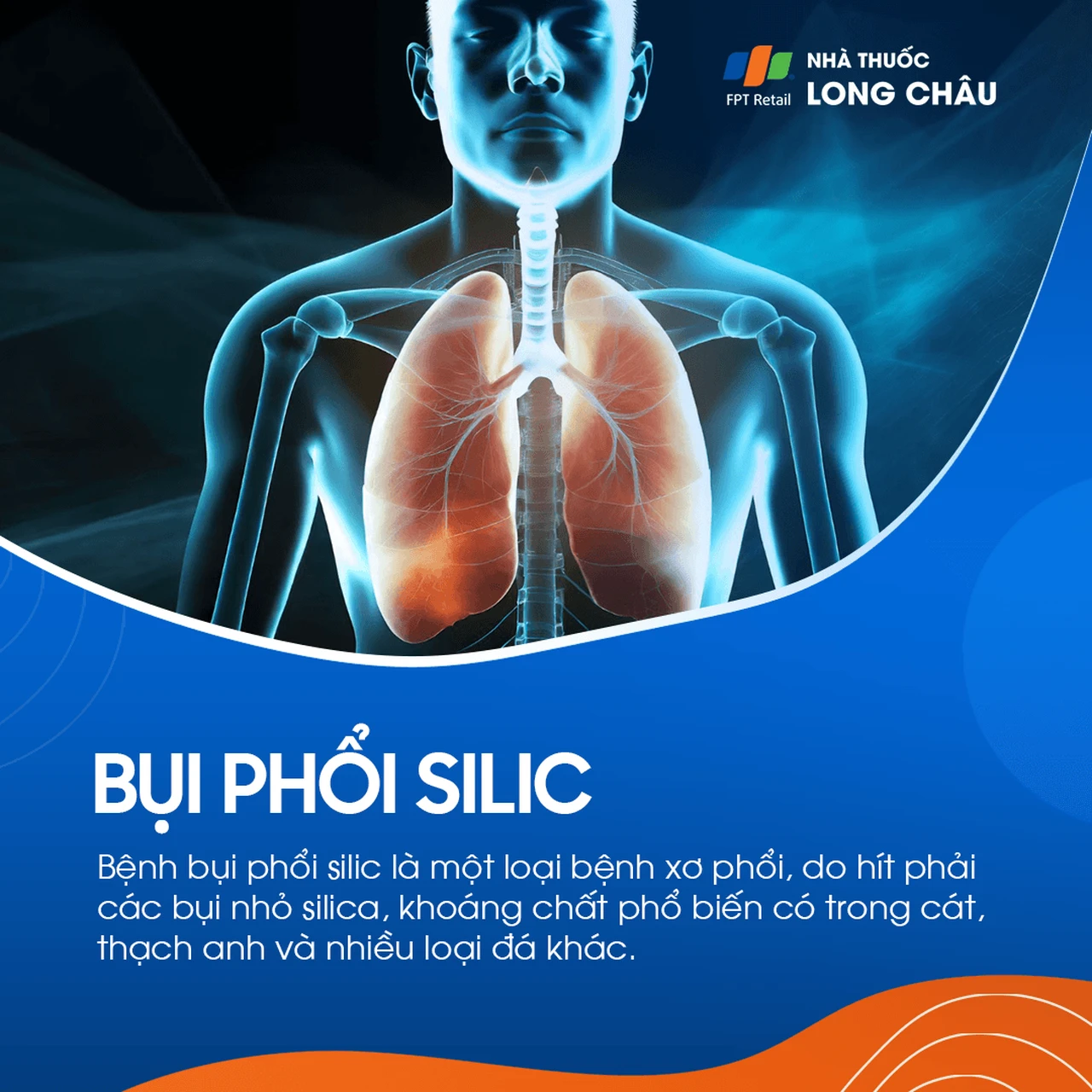 Bụi phổi silic 1