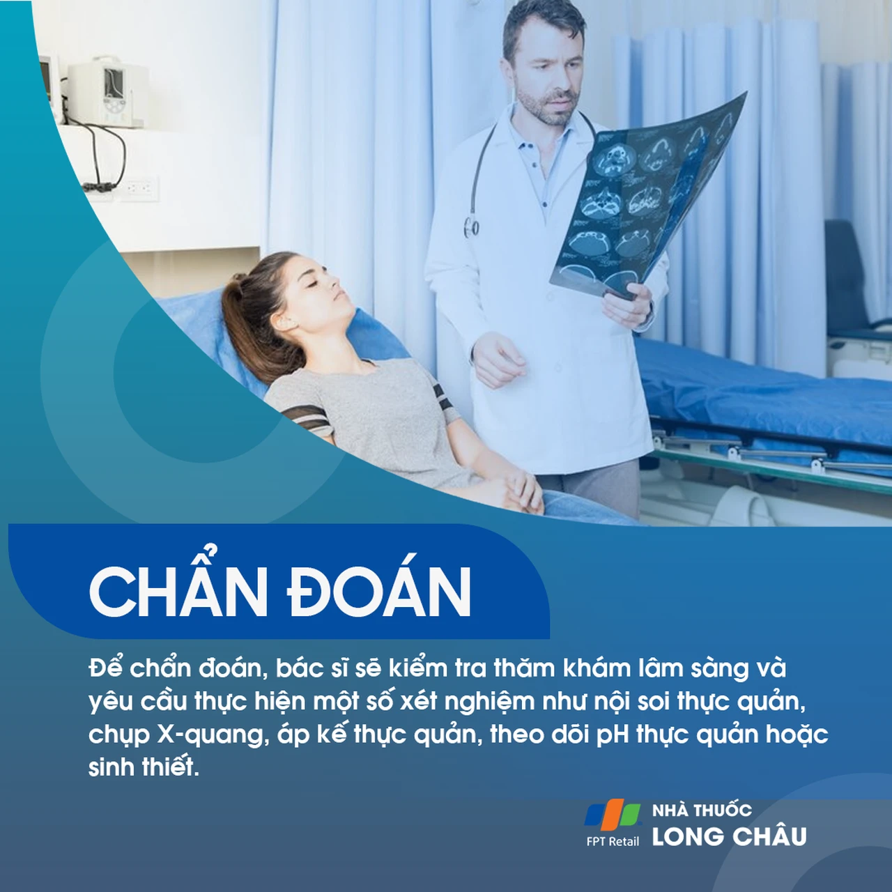 Co thắt thực quản 5