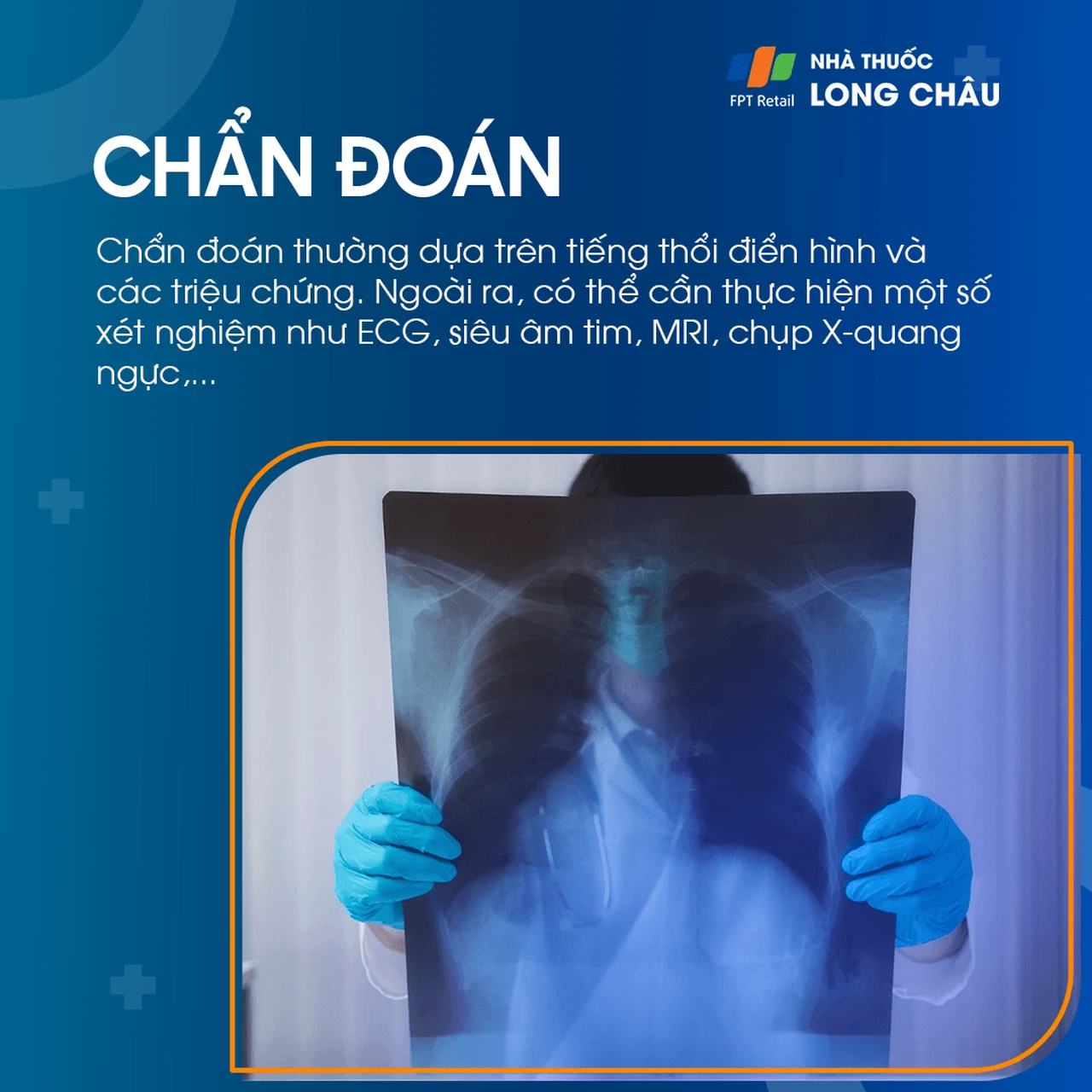 Cơ tim phì đại 5