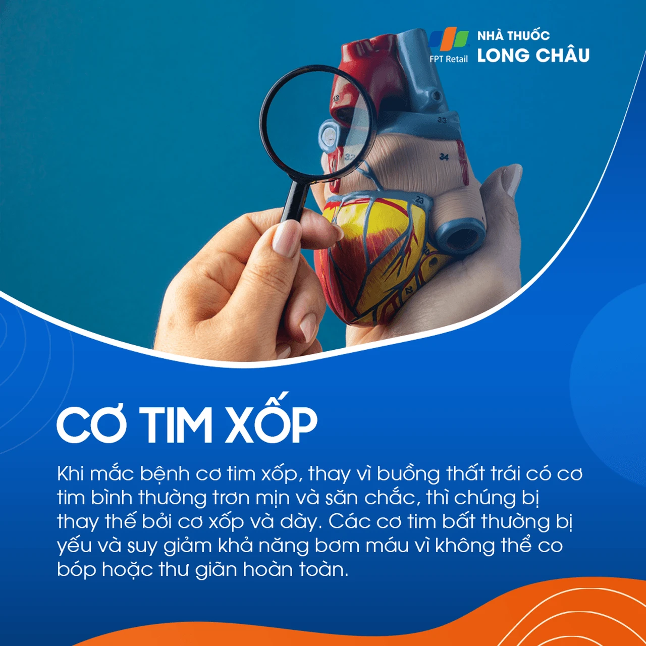 Cơ tim xốp 1