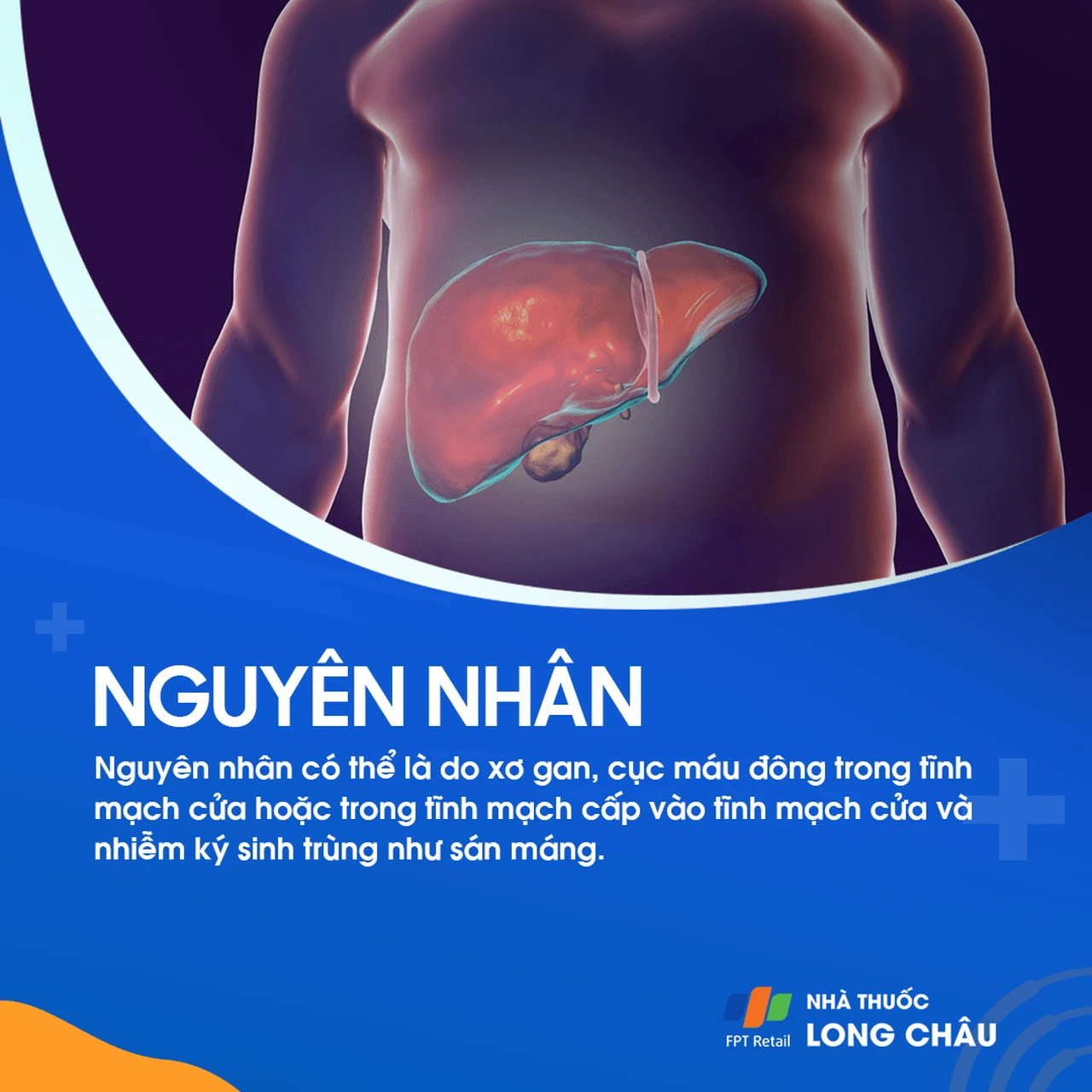 Giãn tĩnh mạch thực quản 3