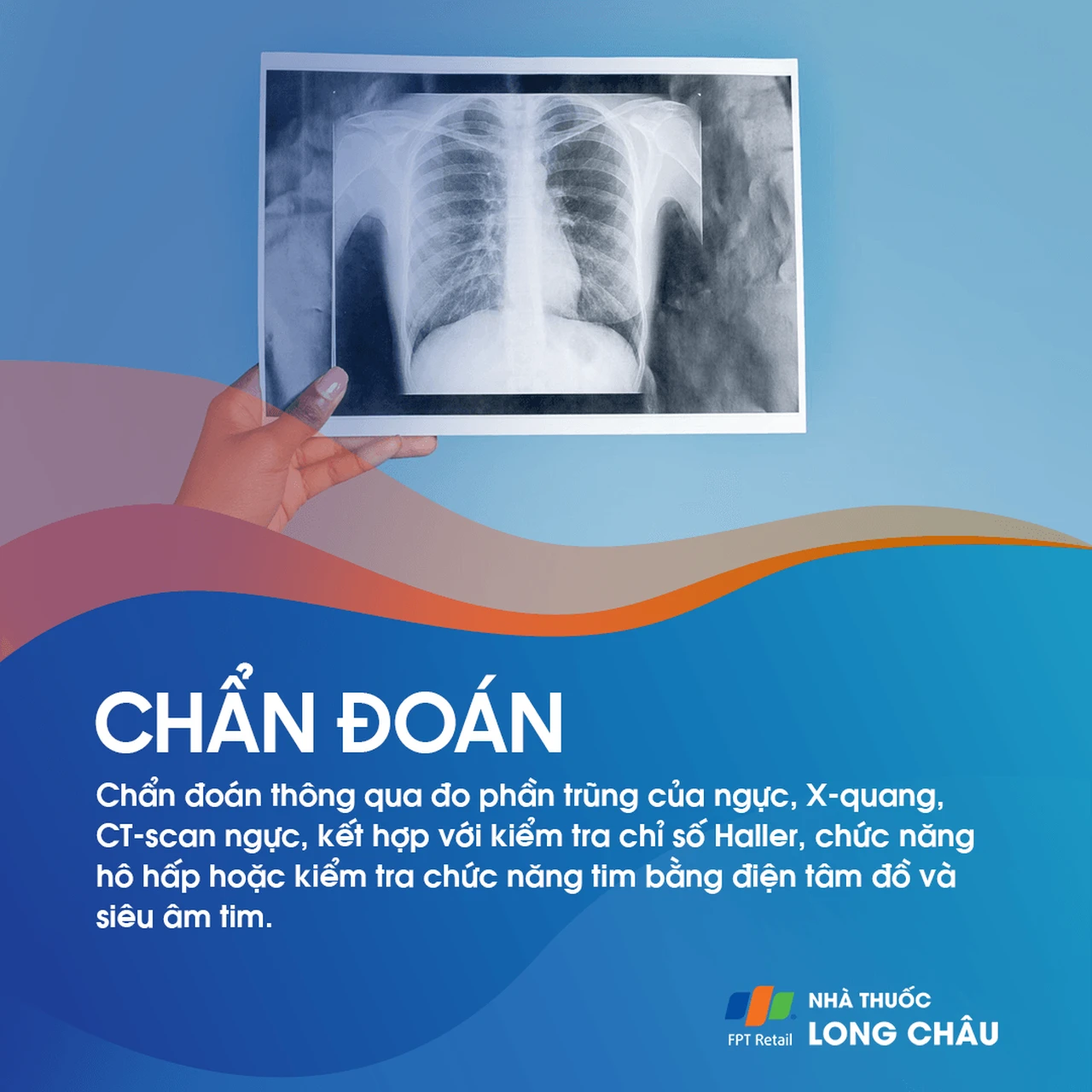 Ngực lỡm bẩm sinh 5