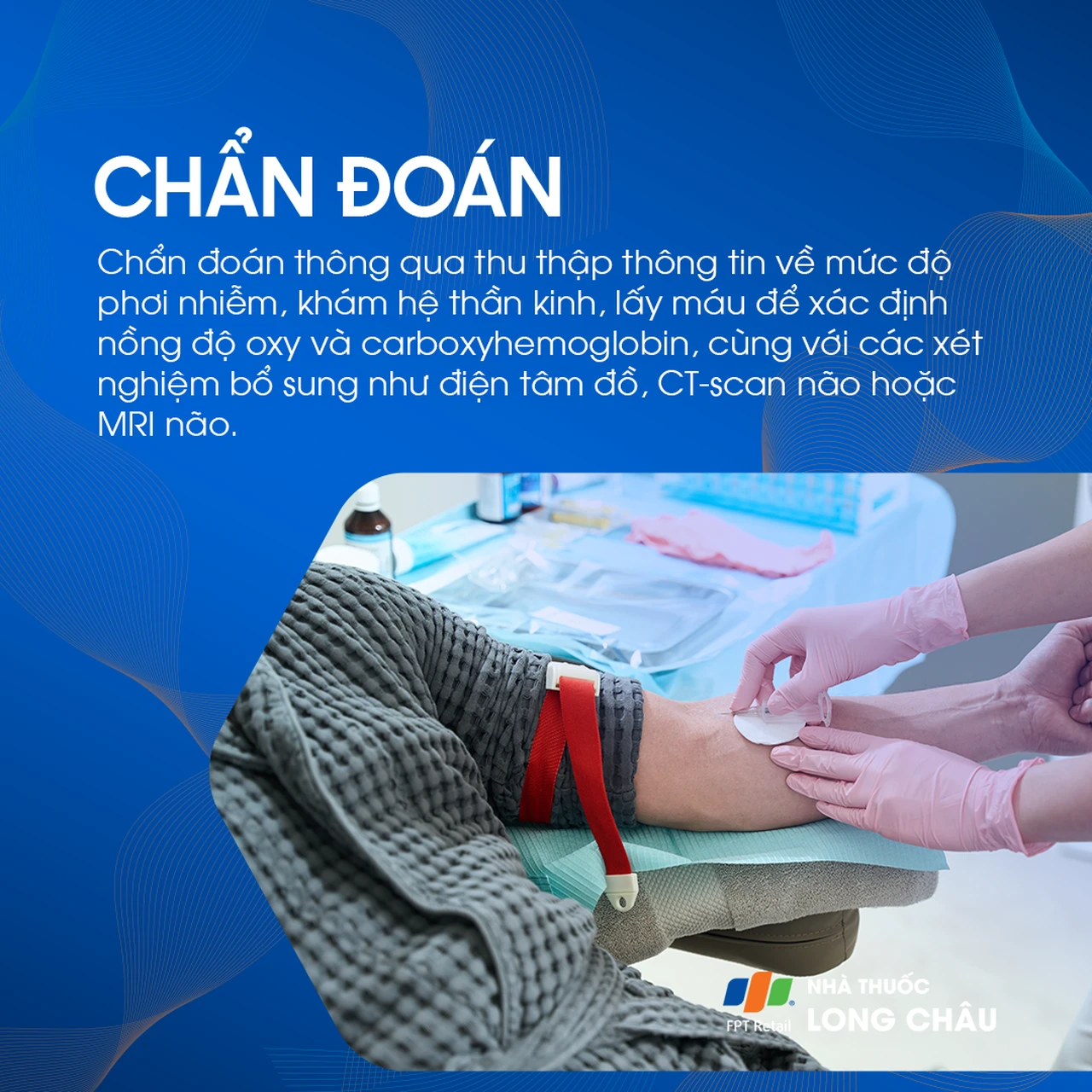 Ngộ độc Carbon Monoxide 5