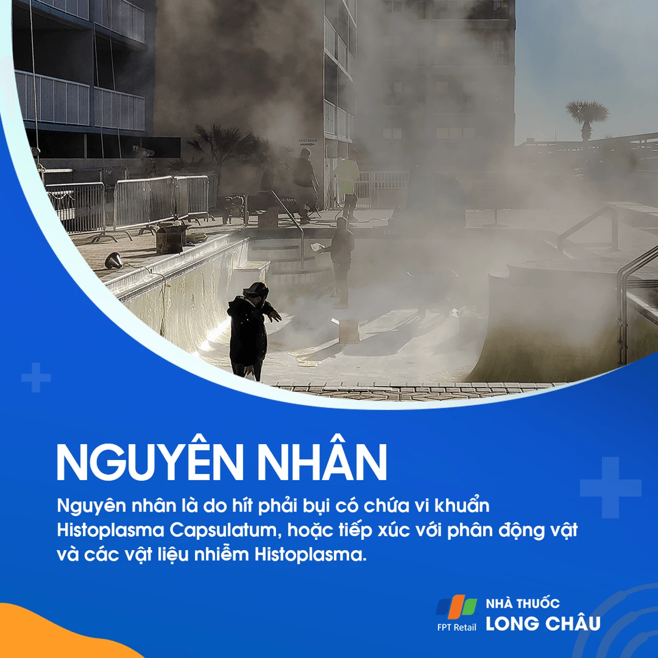 Nhiễm nấm Histoplasma 4