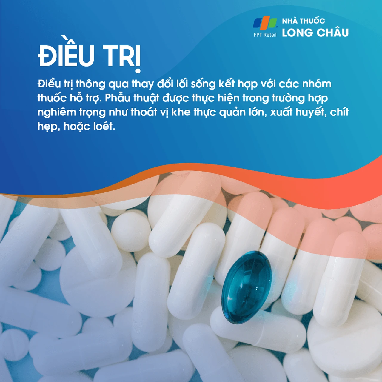 Điều trị trào ngược dạ dày bằng thuốc và thay đổi lối sống