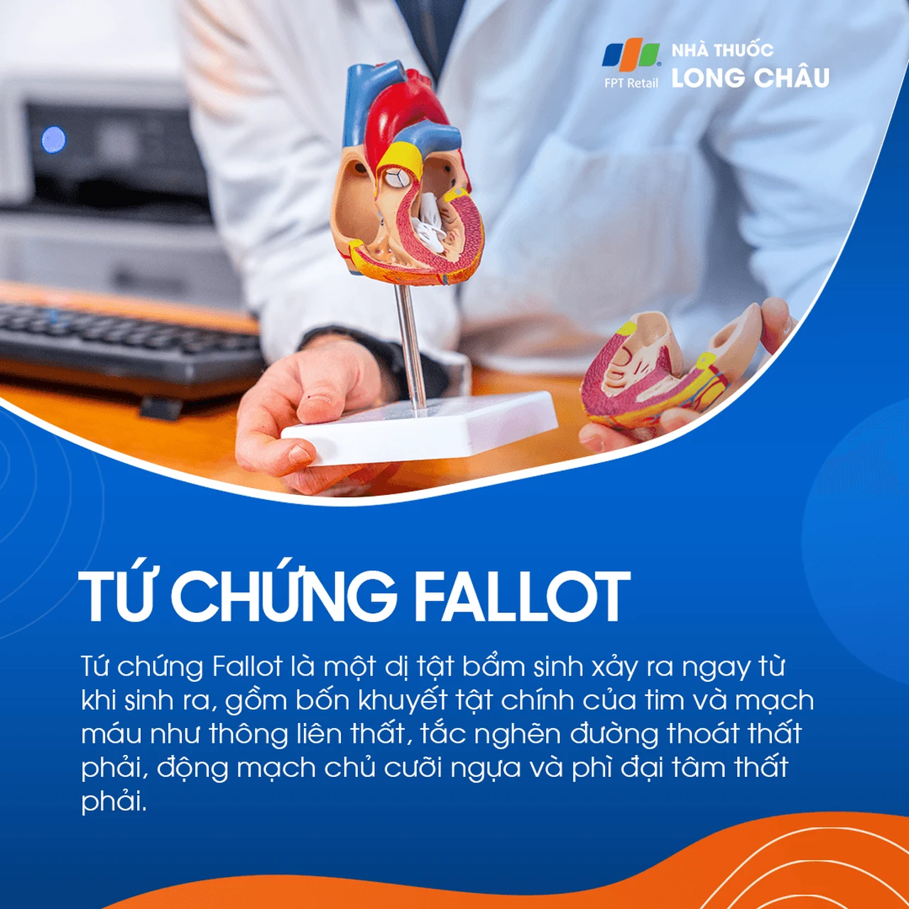 Tứ chứng fallot 1
