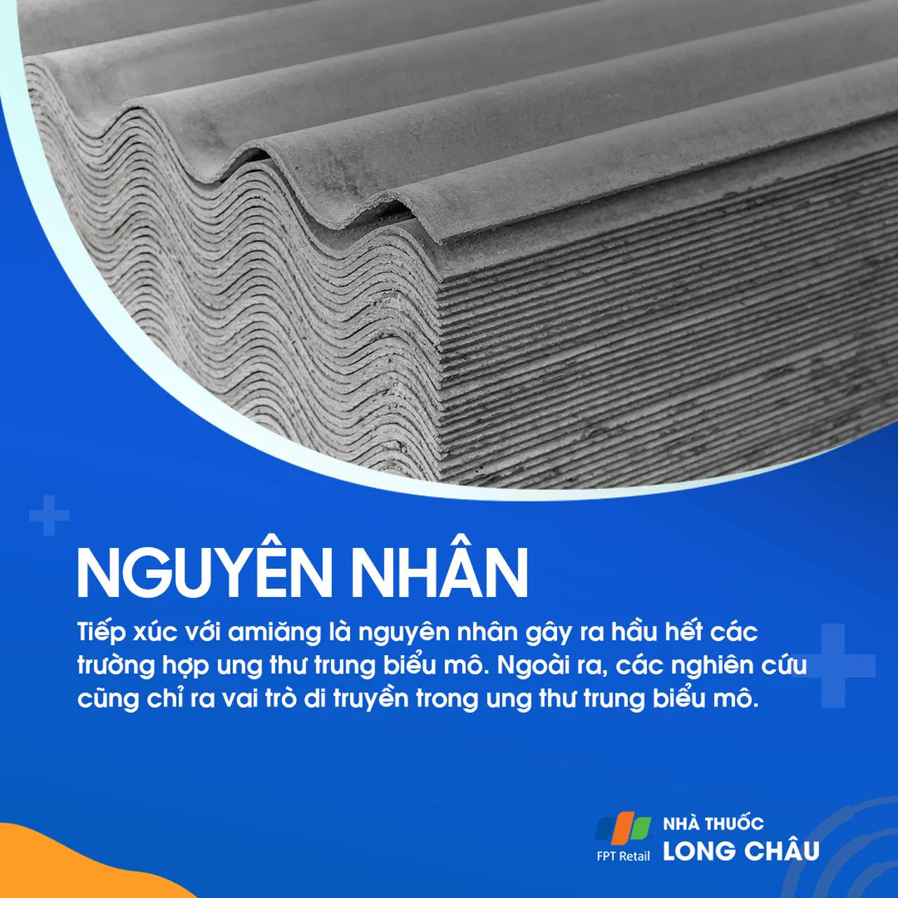 U trung biểu mô 2