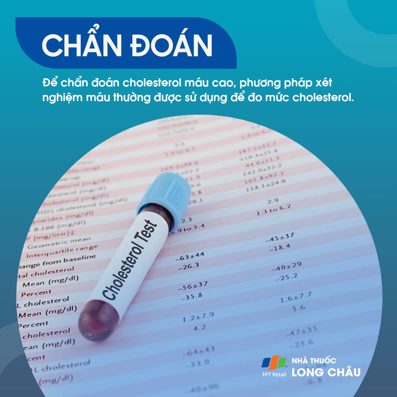 Cholesterol máu cao được phát hiện qua xét nghiệm máu đo chỉ số cholesterol tổng, LDL, HDL và triglyceride