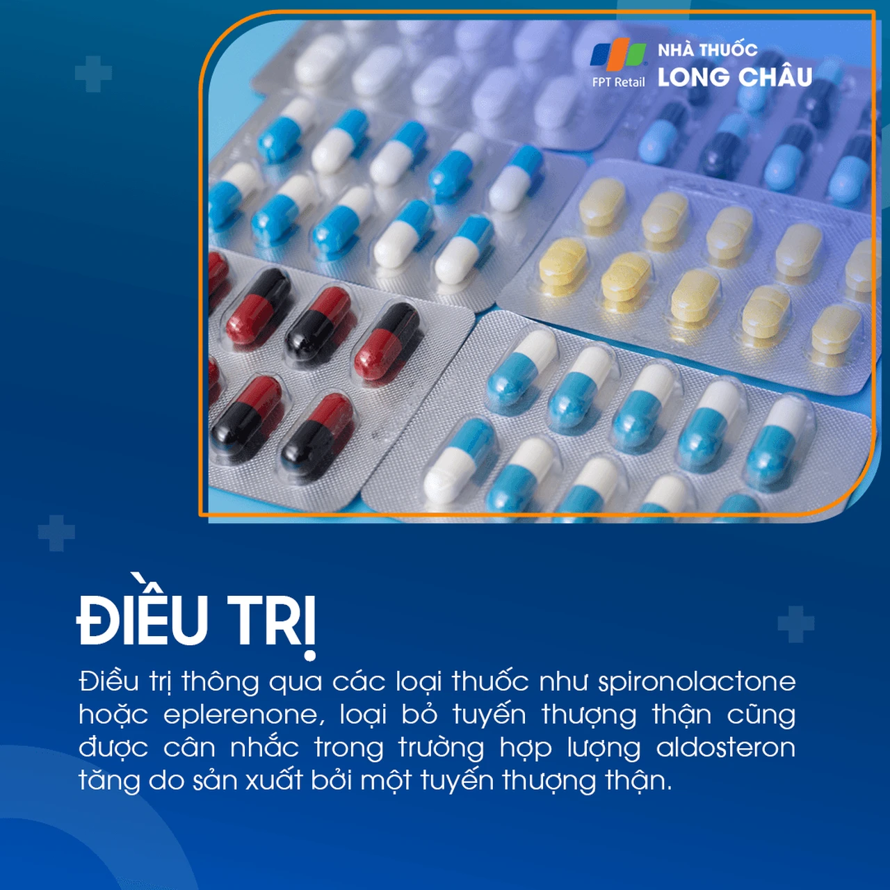 Cường Aldosteron tiên phát 6