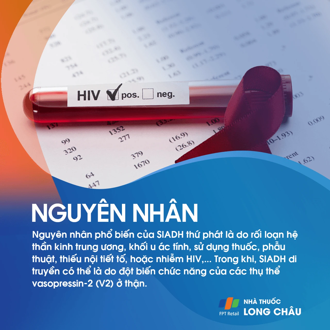 Tăng tiết ADH không thích hợp 3