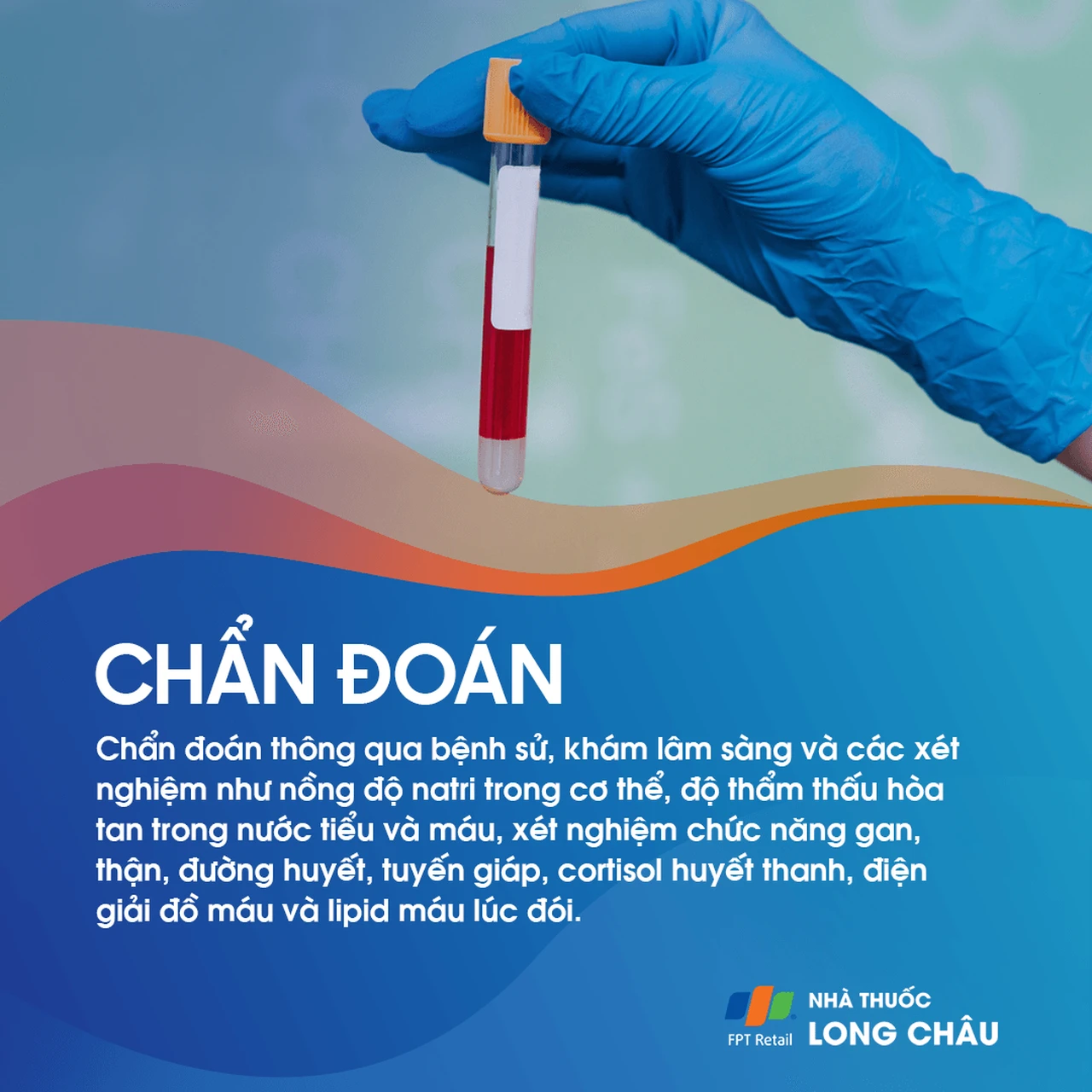 Tăng tiết ADH không thích hợp 5