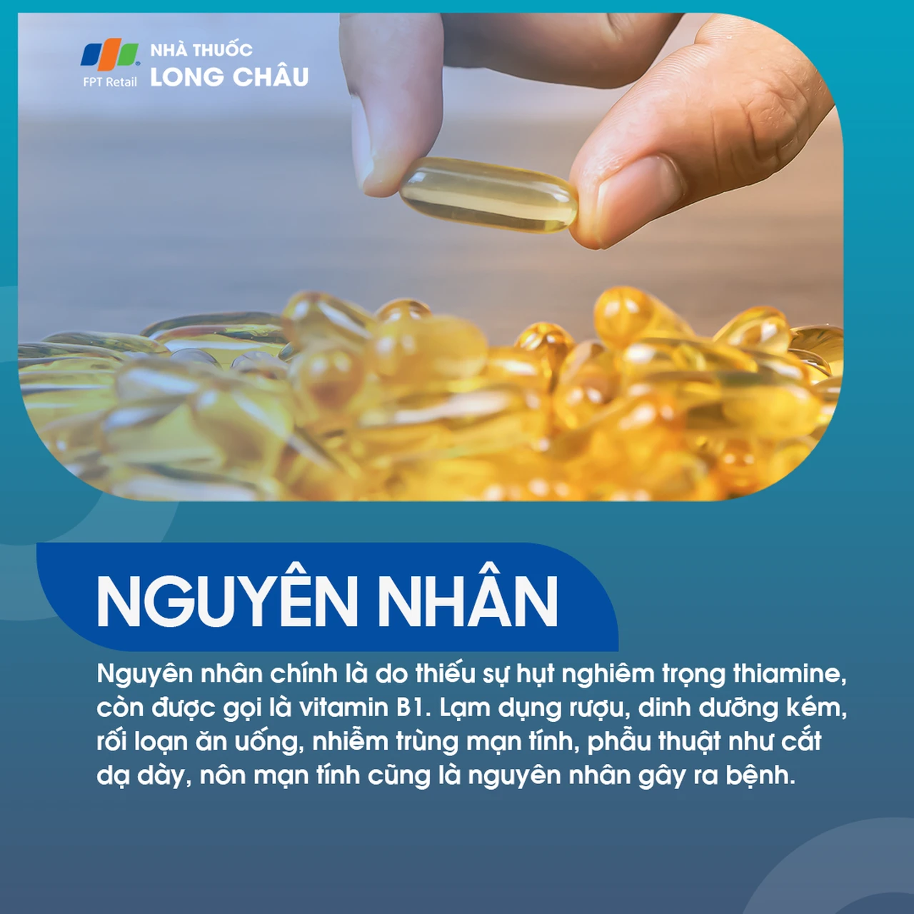 Hội chứng mất trí nhớ Korsakoff 3