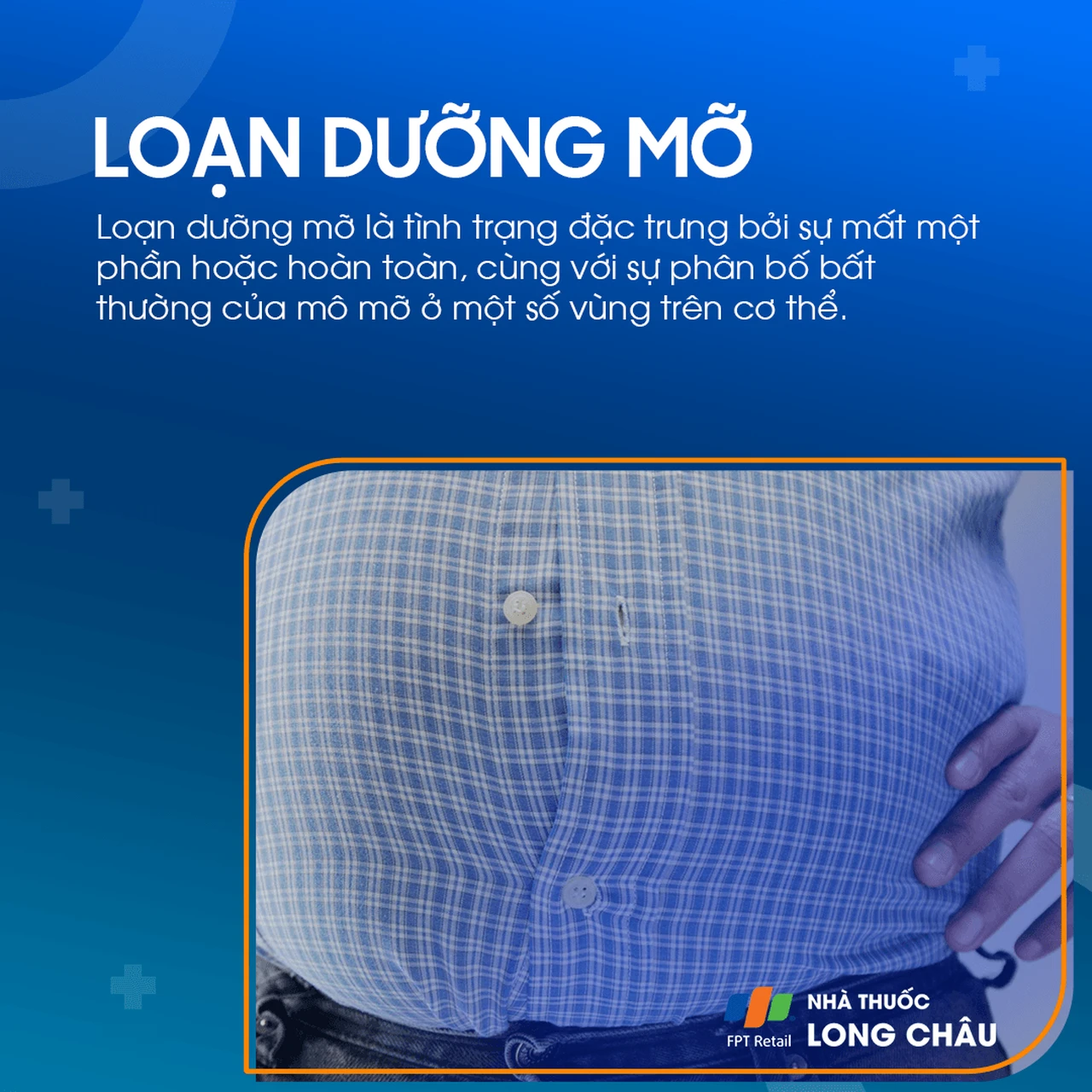 Loạn dưỡng mỡ 1
