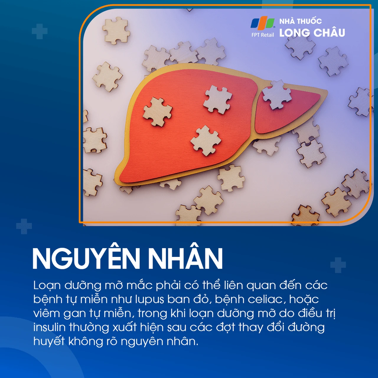 Loạn dưỡng mỡ 4