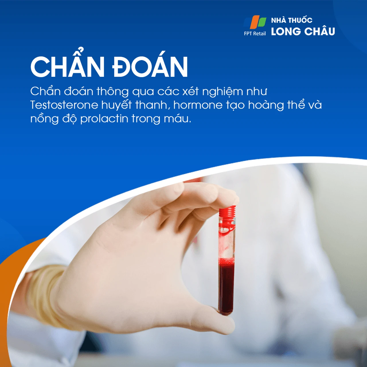 Suy giảm testosterone 7