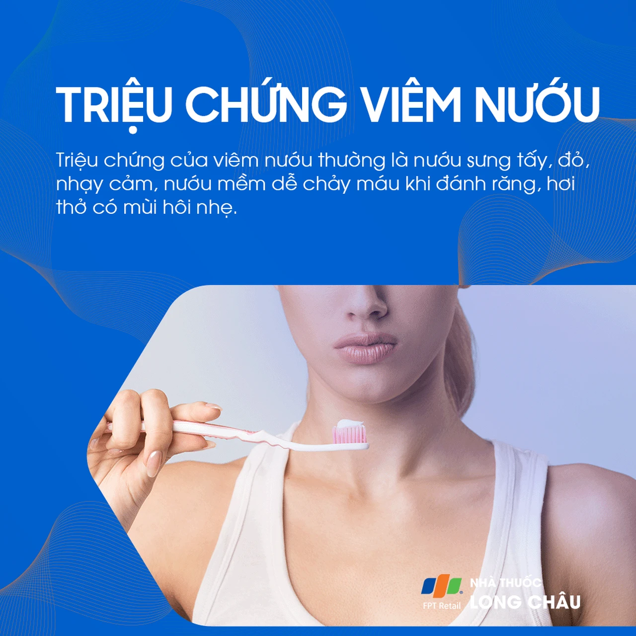 Bệnh nướu và nha chu 2