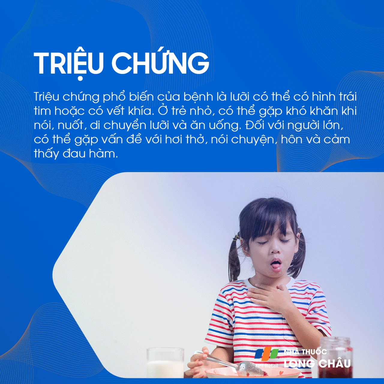 Dính thắng lưỡi 2