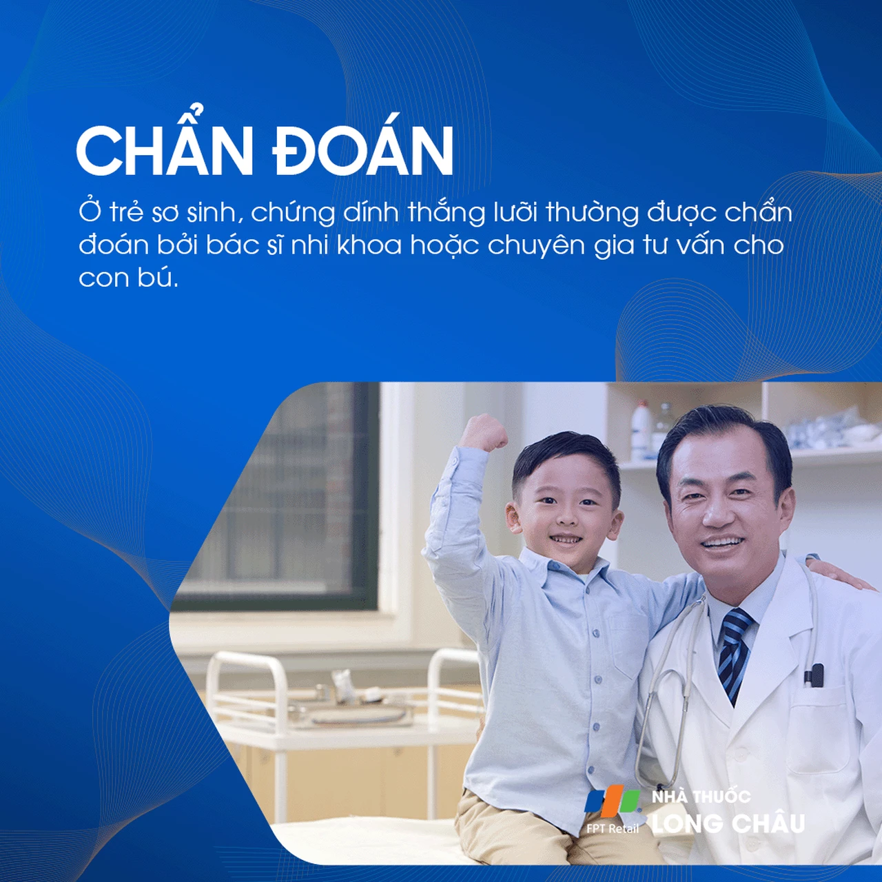 Dính thắng lưỡi 5