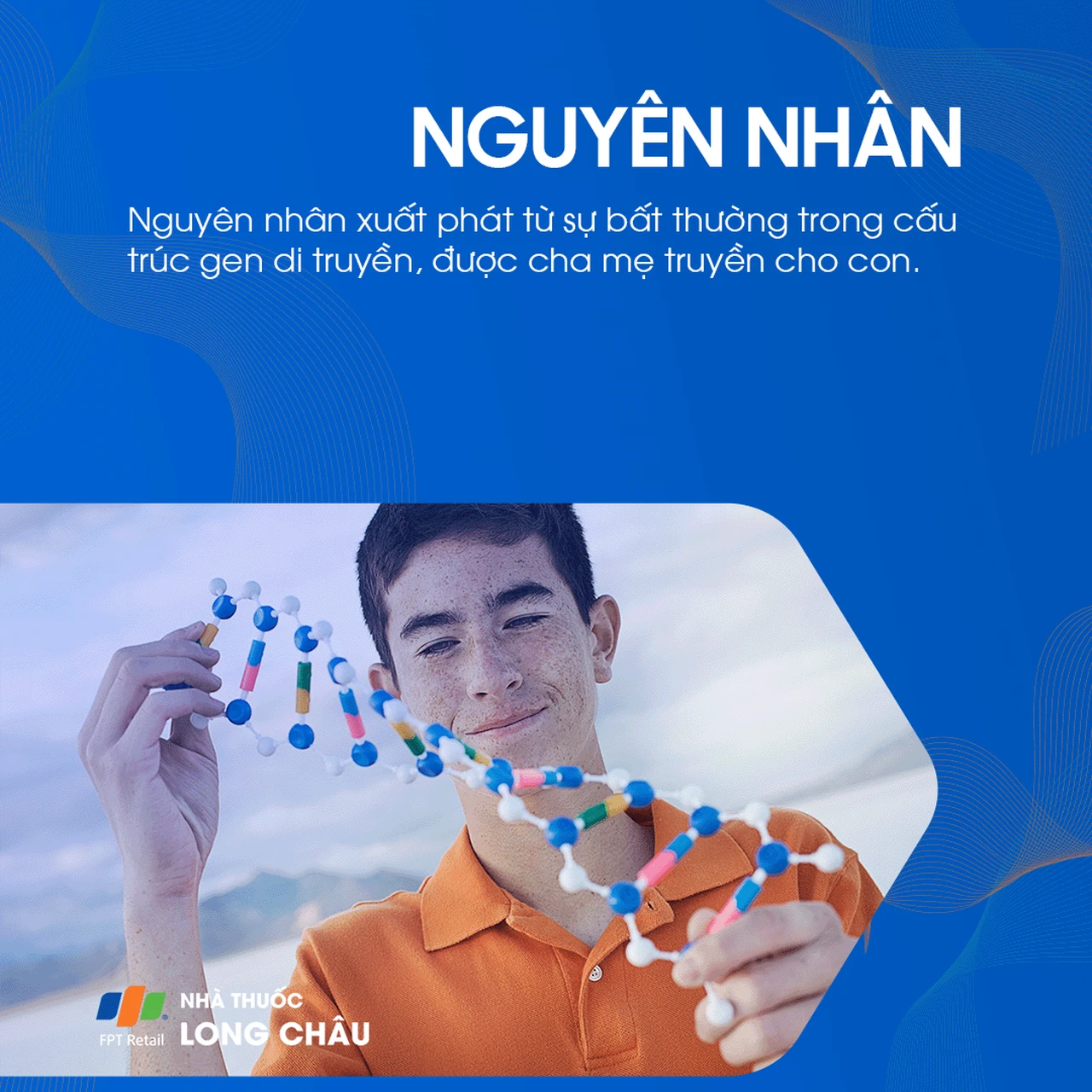 Hội chứng mắt mèo 3