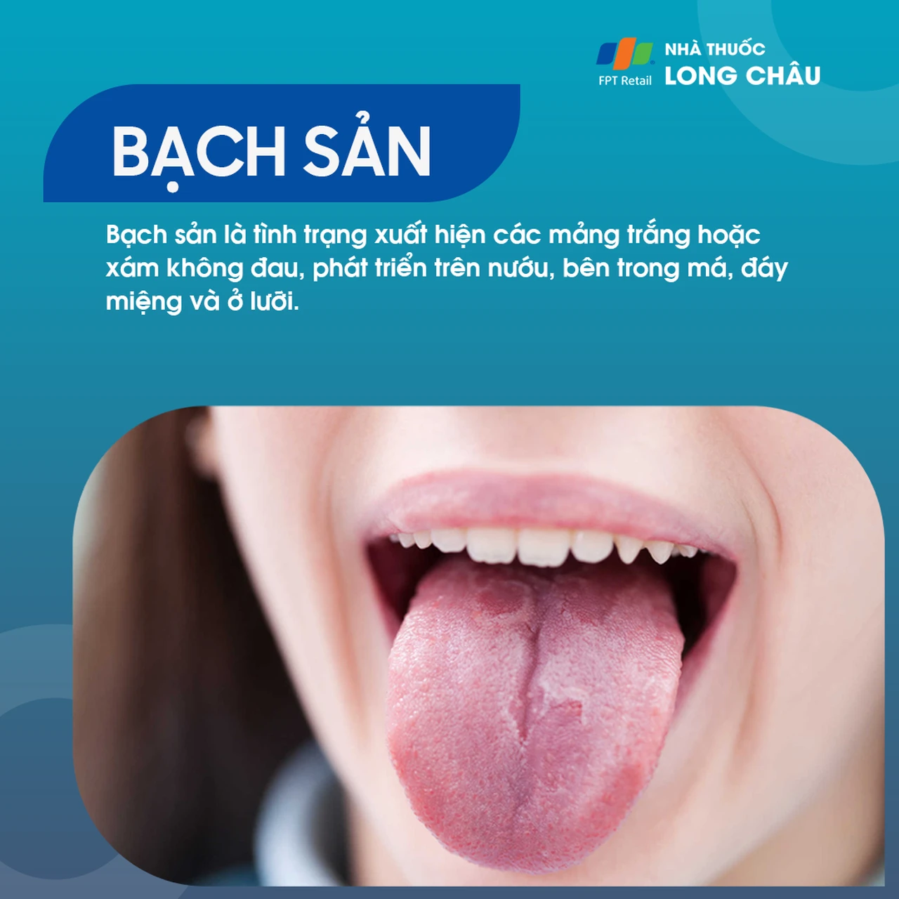 Bạch sản 1