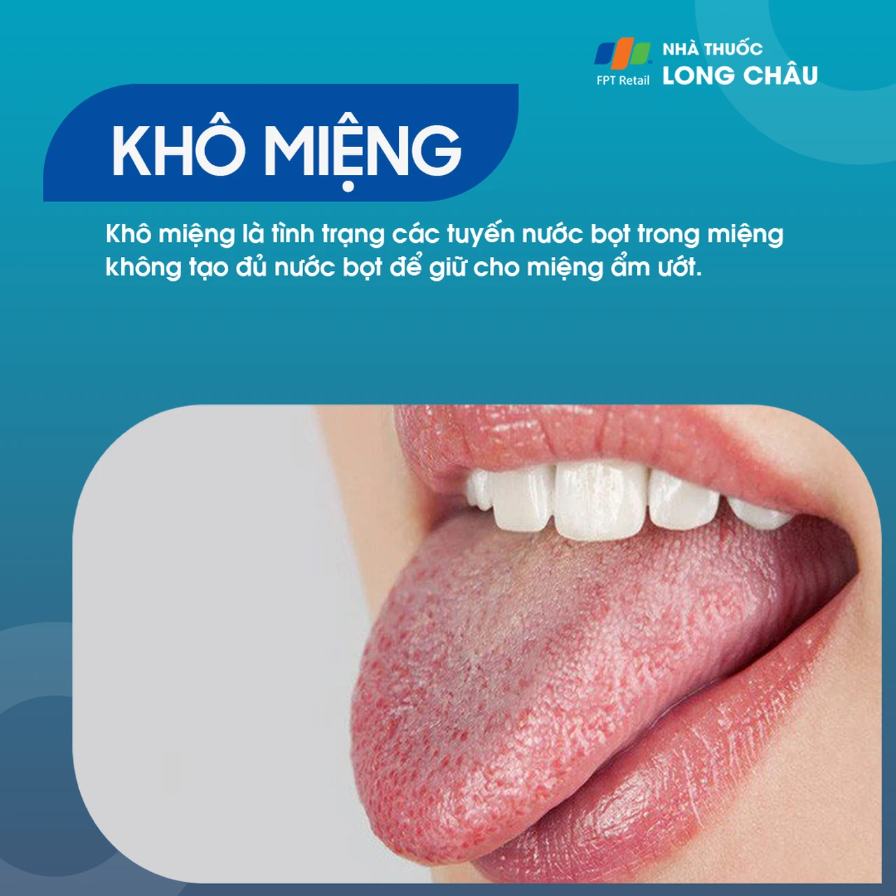 Khô miệng 1