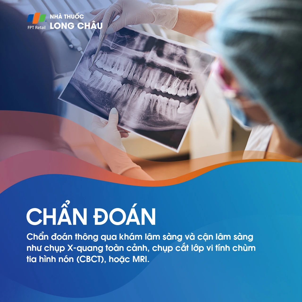 Rối loạn khớp thái dương hàm 5