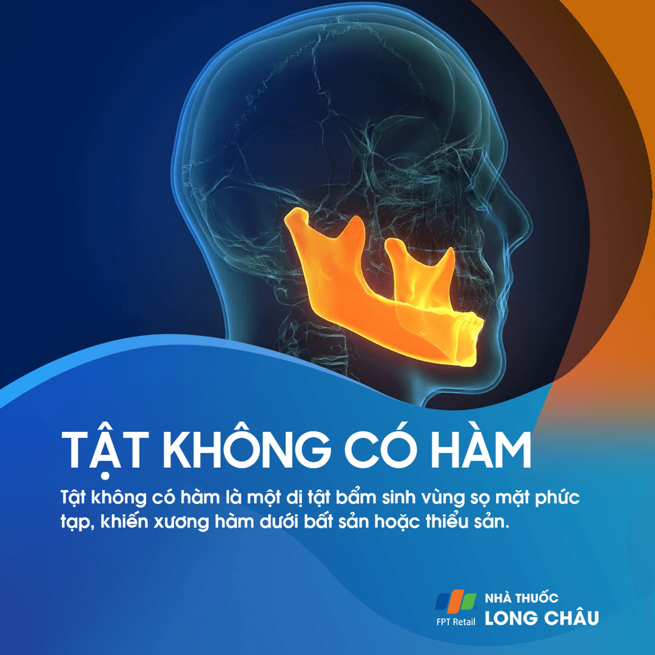 Tật không có hàm 1