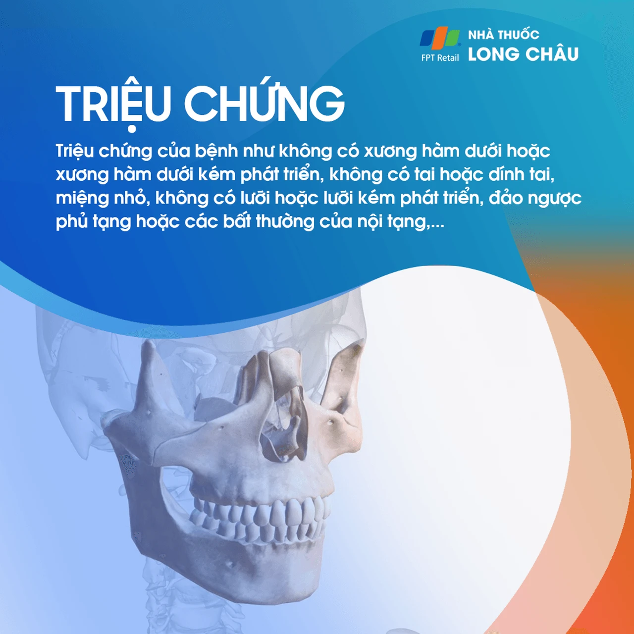 Tật không có hàm 2