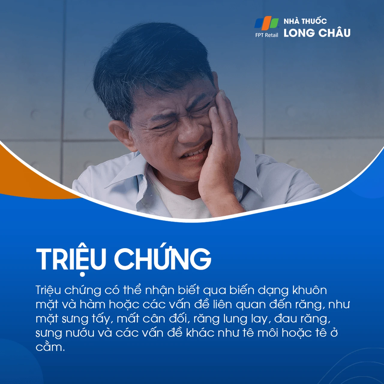 U men xương hàm 2