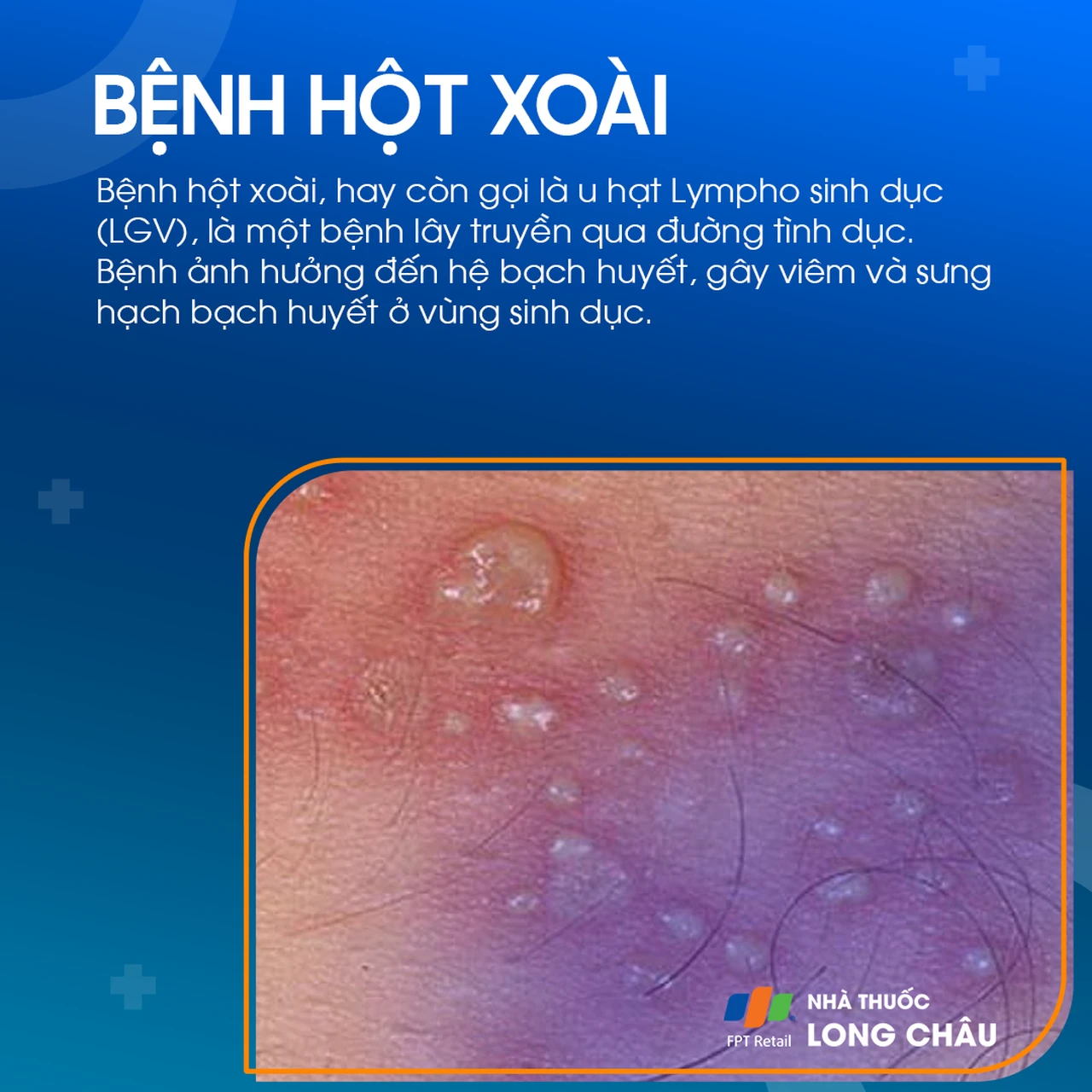 Bệnh hột xoài 1