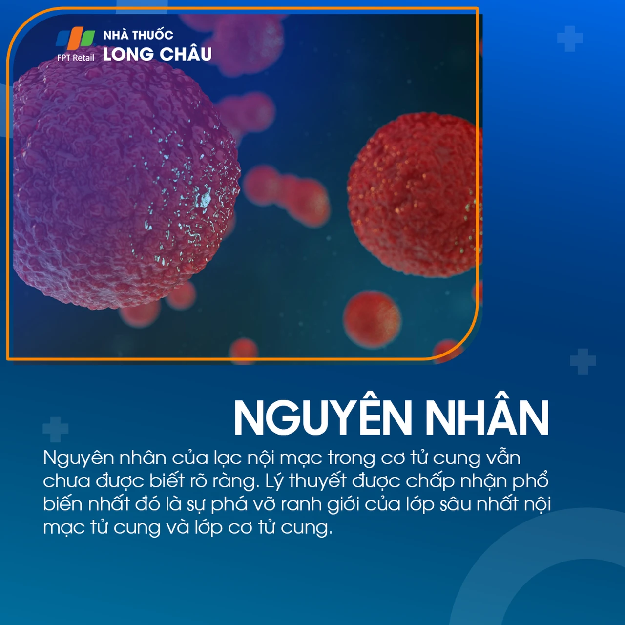 Lạc nội mạc trong cơ tử cung 3