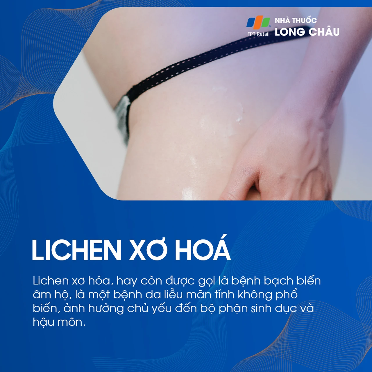 Lichen xơ hóa 1