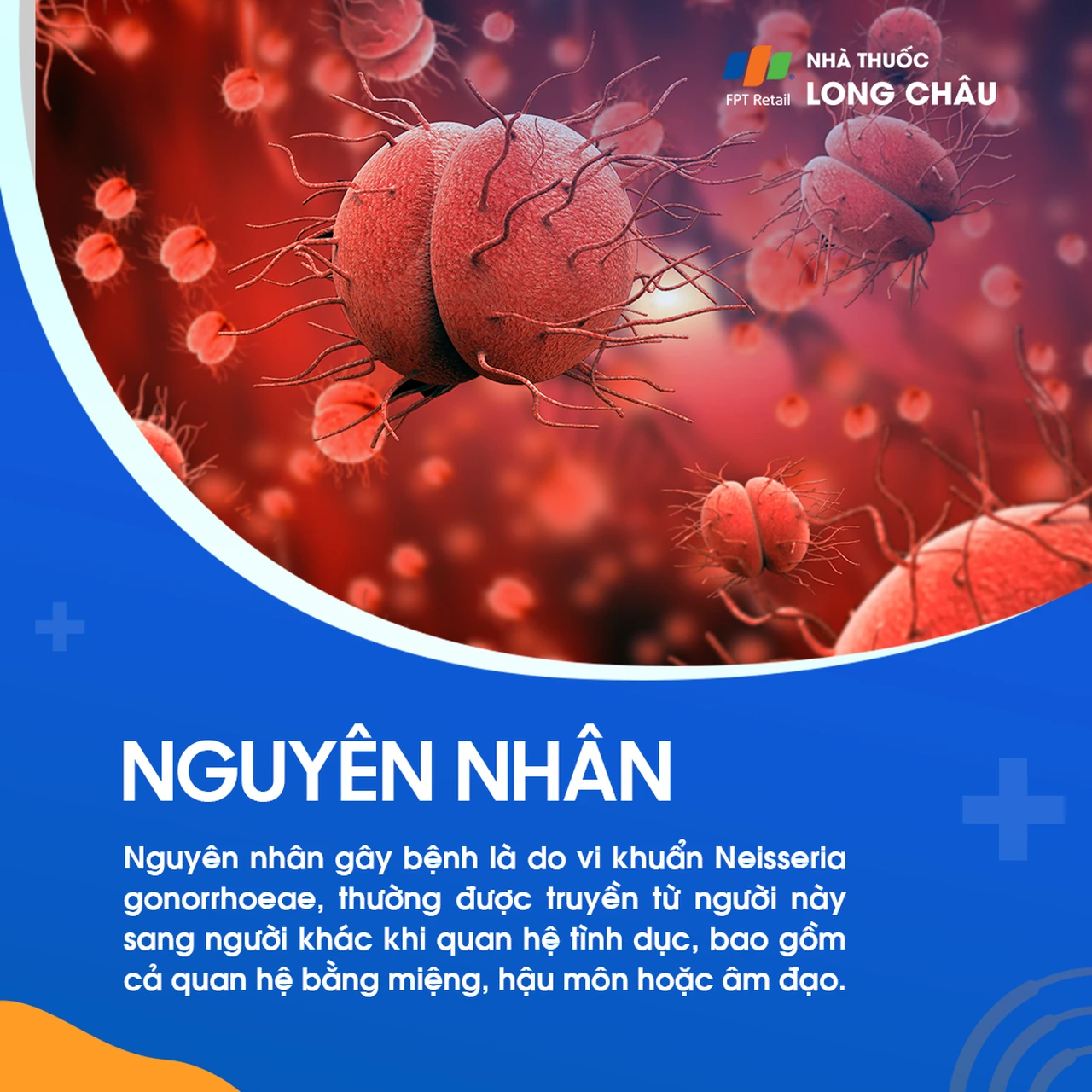 Nhiễm lậu cầu 3