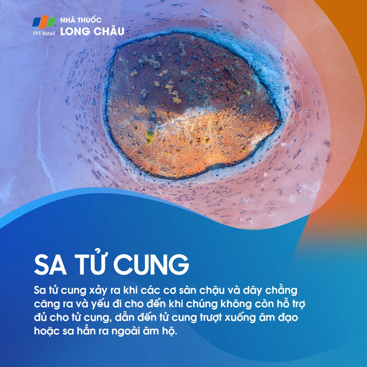 Sa tử cung 1