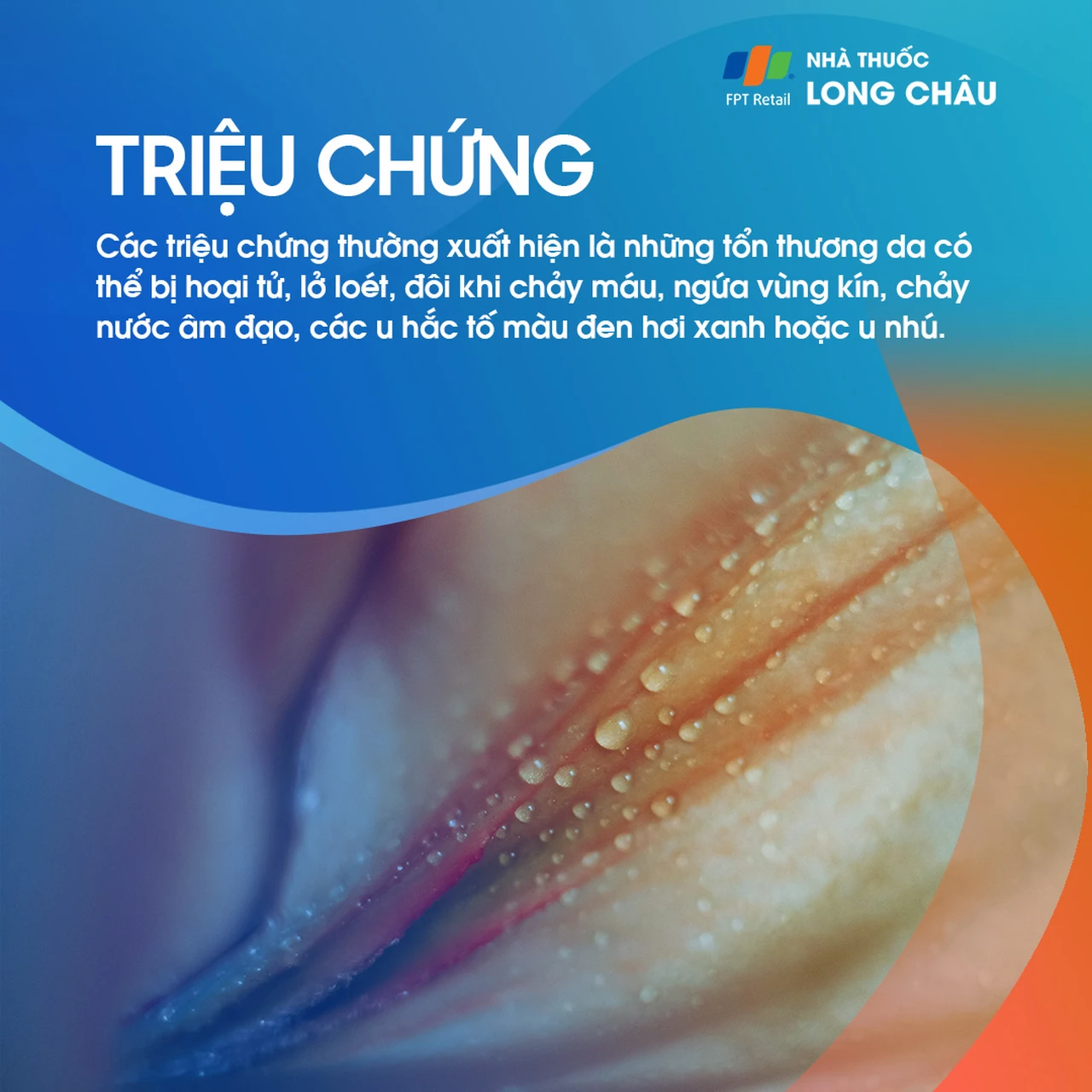 Các dấu hiệu và triệu chứng điển hình của bệnh ung thư âm hộ 