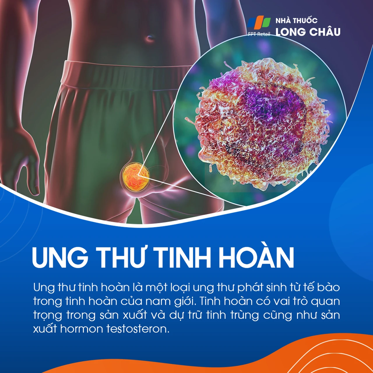 Ung thư tinh hoàn 1
