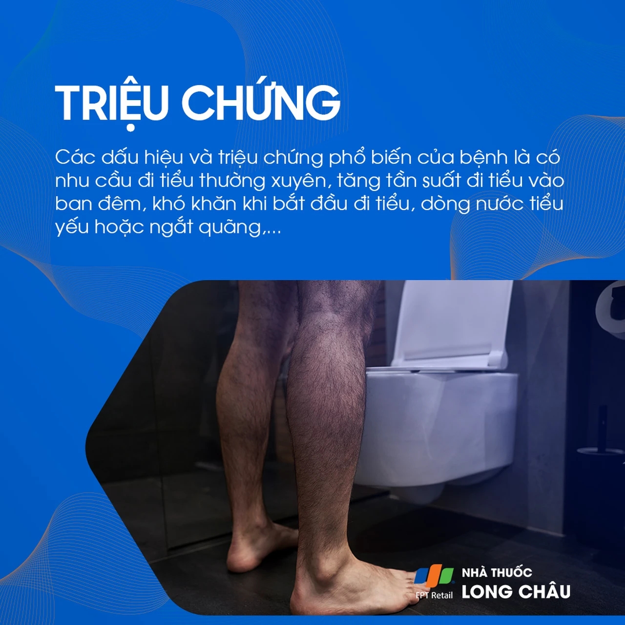 U xơ tuyến tiền liệt 2