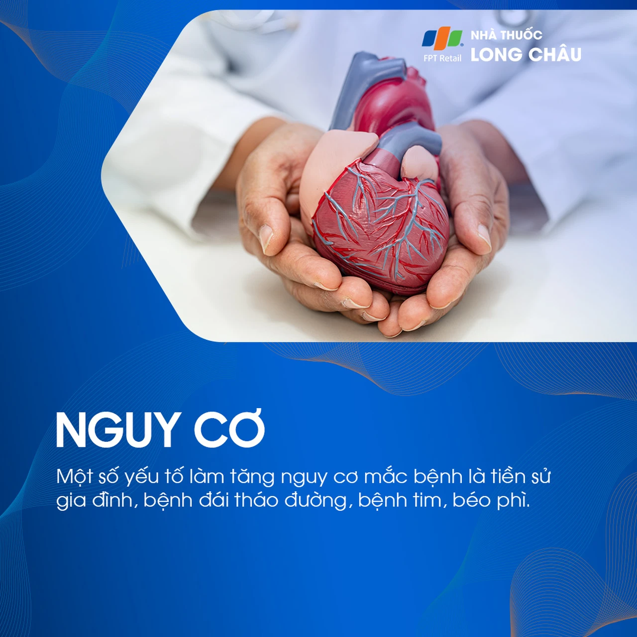 U xơ tuyến tiền liệt 4