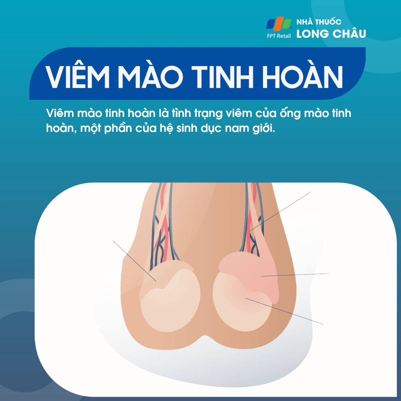 Viêm mào tinh hoàn 1