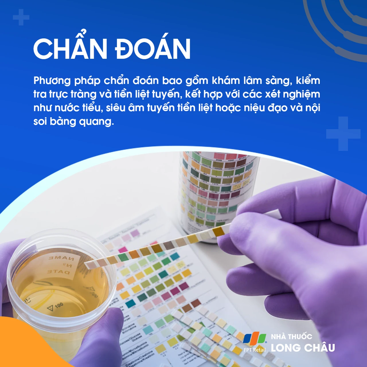 Viêm tuyến tiền liệt mạn tính 5