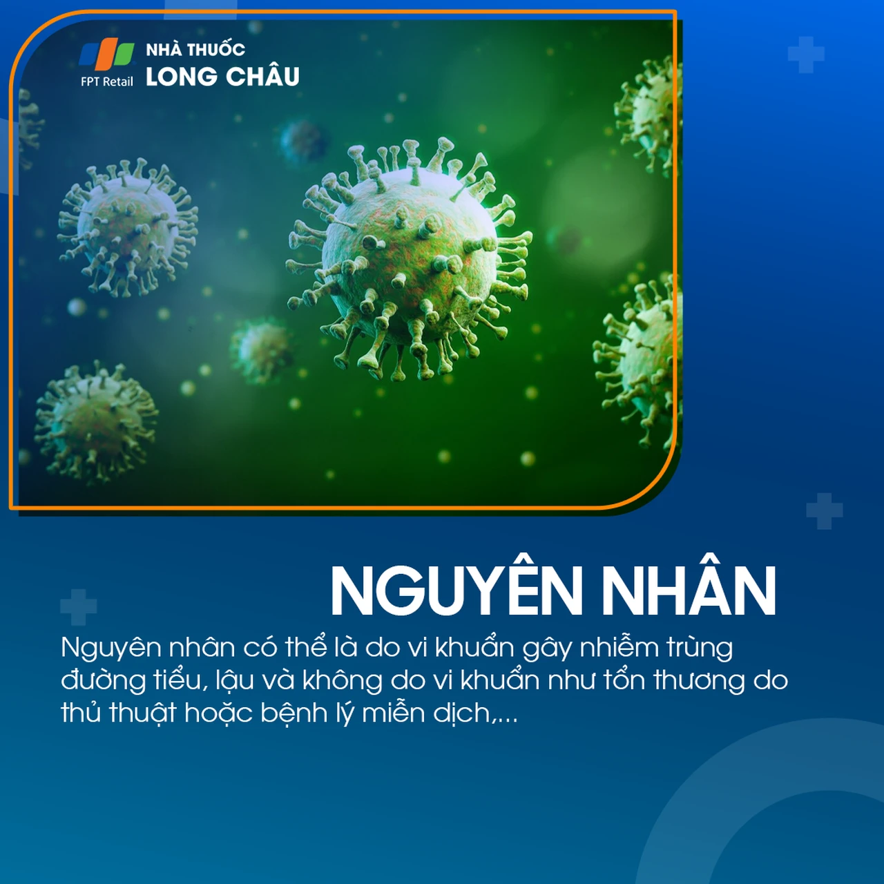 Viêm tuyến tiền liệt cấp tính 3