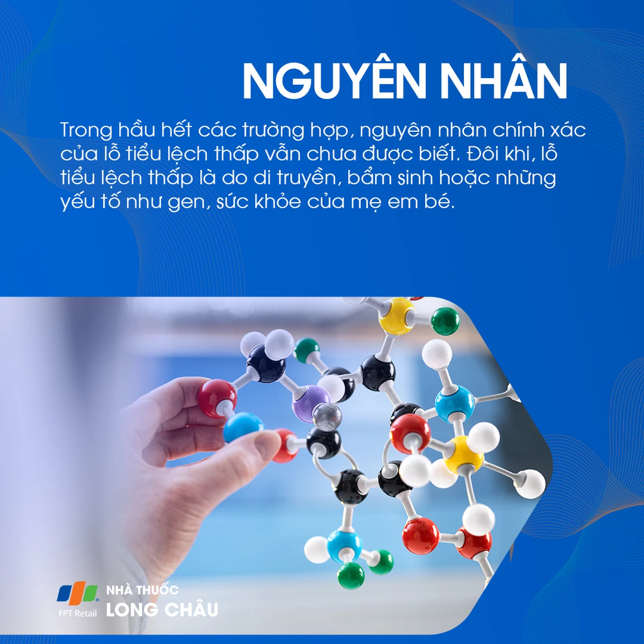 Lỗ tiểu lệch thấp 3