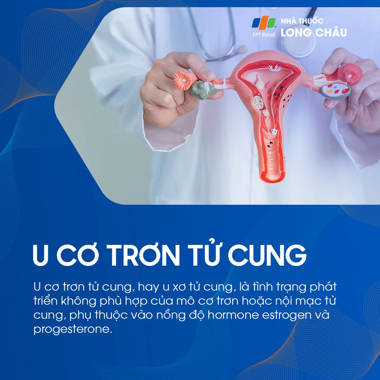 U cơ trơn tử cung 1