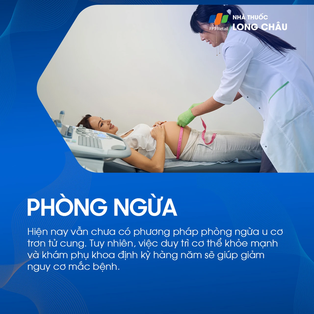 U cơ trơn tử cung 7