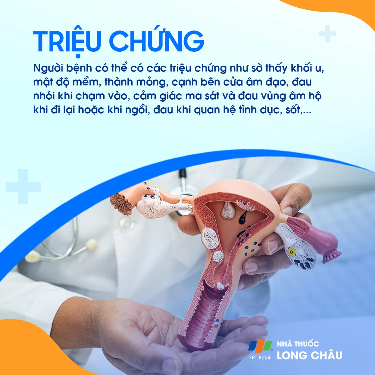 U nang tuyến Bartholin 2